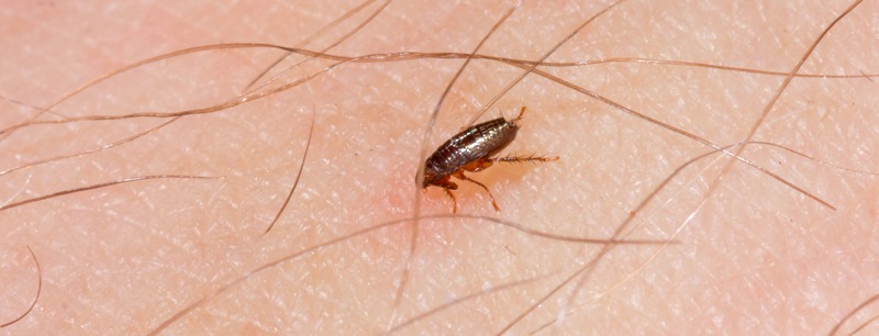 A little flea bites on a human