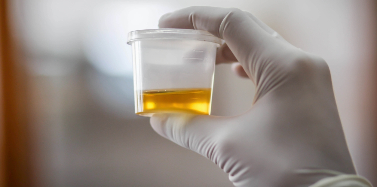 a urine sample