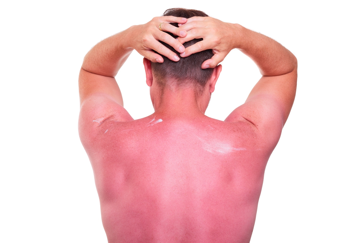 Man with tanned back in red on white