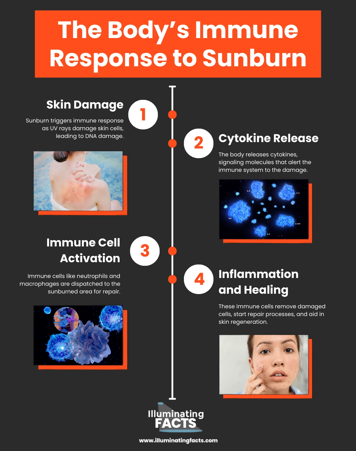 The Body’s Immune Response to Sunburn